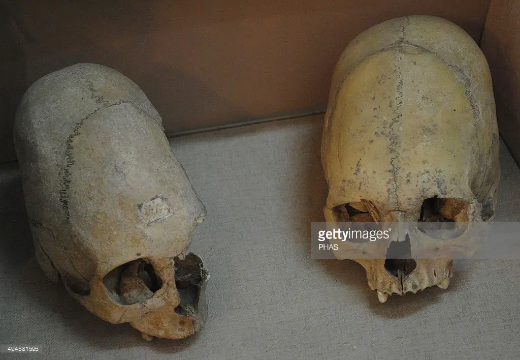 Sarmatians. Two deformed human skulls. Probably dated in the 3rd century BC. Kerch Historical and Archaeological Museum. Autonomous Republic of Crimea. Ukraine. Notice their similarity to the Paracas skulls found half way around the world in Peru. 